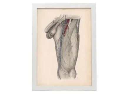 Poster NACNIC De Dissecção Estrept E Triange Femoral Ilustrações Decorativas De Anatomia E Medicina Em Estilo Vintage Tamanho A4 Com Quadro Preto