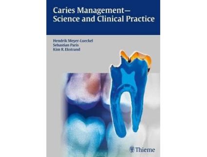 Livro Caries Management - Science and Clinical Practice (Inglês)