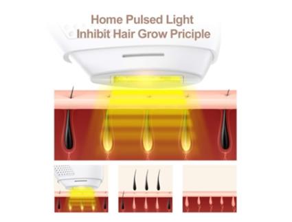 Depilação Por Ipl Sistema de Depilação Indolor Profissional ENZONS
