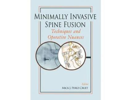 Livro Livro Minimally Invasive Spine Fusion: Techniques and Operative Nuances de Vários Autores (Inglês) de Mick Perez Cruet, Rudolf Beisse, Luiz Pimenta, Daniel Kim ( Inglês )
