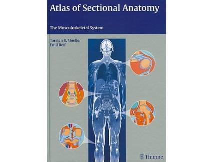 Livro Atlas of Sectional Anatomy The Musculoskeletal System de Torsten Bert Möller Emil Reif (Inglês)