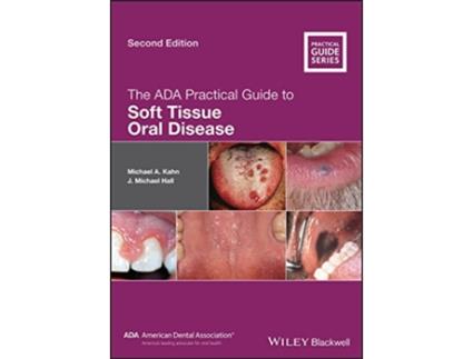 Livro The ADA Practical Guide to Soft Tissue Oral Disease de Michael A Kahn J Michael Hall (Inglês)