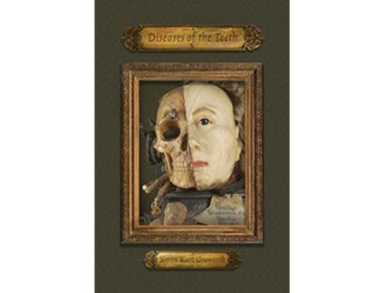 Livro Diseases of the Teeth de Simon Kurt Unsworth (Inglês)