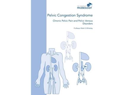 Livro Pelvic Congestion Syndrome Chronic Pelvic Pain and Pelvic Venous Disorders de Mark S Whiteley (Inglês)