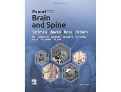 Livro ExpertDDx Brain and Spine de Karen L Salzman Md, Miral D Jhaveri Md Mba et al. (Inglês - Capa Dura)