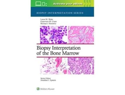Livro Biopsy Interpretation of the Bone Marrow de Laura M Wake Md, Genevieve M Crane Md Phd et al. (Inglês - Capa Dura)