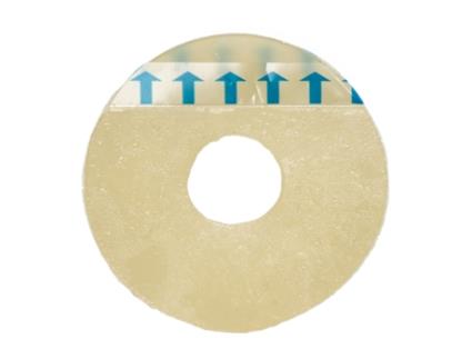 Acessório Ostomia Aneis Moldáveis 50Mm OXMED
