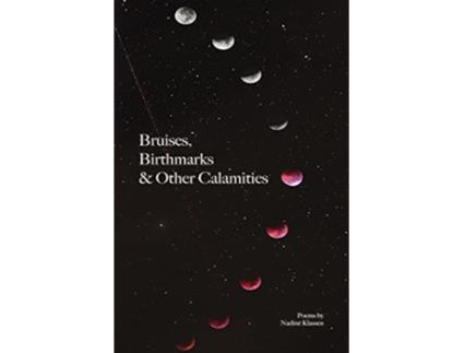 Livro Bruises Birthmarks Other Calamities de Nadine Klassen (Inglês)