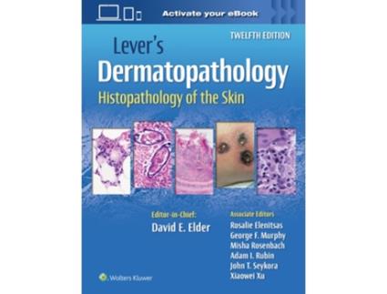 Livro Levers Dermatopathology Histopathology of the Skin de David E Elder MB ChB FRCPA (Inglês - Capa Dura)