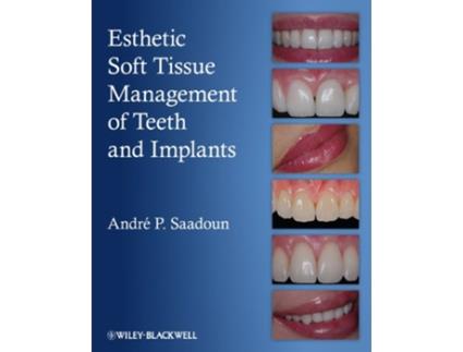 Livro Esthetic Soft Tissue Management of Teeth and Implants de Andre P Saadoun (Inglês)