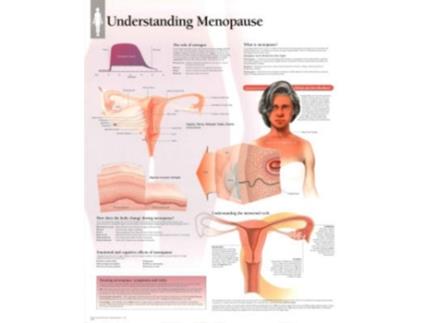 Livro Understanding Menopause Laminated Poster de Scientific Publishing e Various (Inglês)