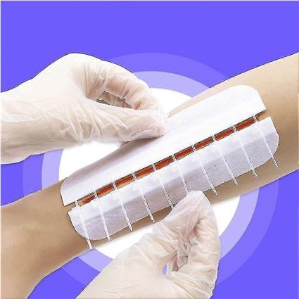 Dispositivo de fechamento de feridas indolor com zíper Band-aid - 4/10pcs Pack