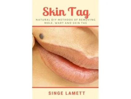 Livro Skin Tag Natural Diy Methods Of Removing Mole, Wart And Skin Tag De Singe Lamett (inglês)