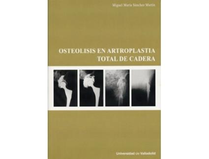 Livro Osteolisis En Artroplastia Total De Cadera de Miguel Maria Sanchez Martin (Espanhol)