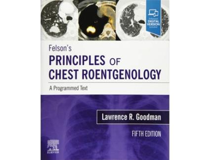 Livro Felson´S Principles Of Chest Roentgenology A Programmed de Goodman (Inglês)