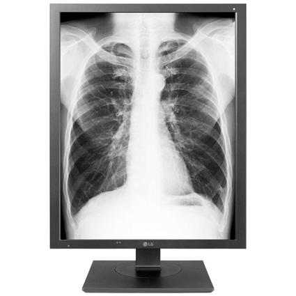 Medical Display 21"" 3:4 21HK512D