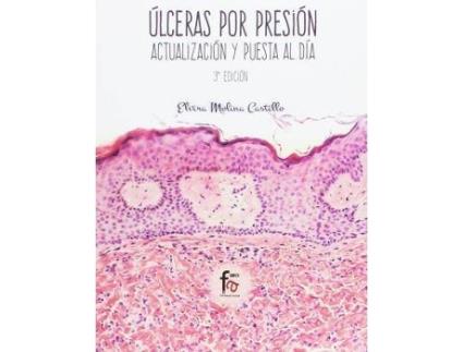 Livro Úlceras Por Presión de Elvira Molina Castillo (Espanhol)