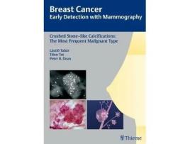 Livro breast cancer: early detection with mammography de laszlo tabar,tibor tot,peter b. dean (inglês)