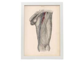 Poster NACNIC De Dissecção Estrept E Triange Femoral Ilustrações Decorativas De Anatomia E Medicina Em Estilo Vintage Tamanho A4 Com Quadro Preto
