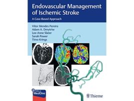 Livro Endovascular Management of Ischemic Stroke de Vitor Pereira, Adam Dmytriw et al. (Inglês)