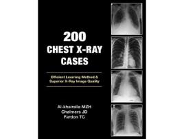 Livro 200 Chest XRay Cases de Mudher AlKhairalla James Chalmers Tom Fardon (Inglês)