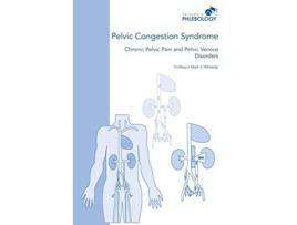 Livro Pelvic Congestion Syndrome Chronic Pelvic Pain and Pelvic Venous Disorders de Mark S Whiteley (Inglês)
