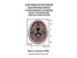 Livro Low Resolution Brain Electromagnetic Tomography LORETA Basic Concepts and Clinical Applications de Rex Cannon (Inglês)