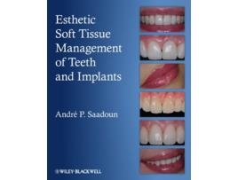 Livro Esthetic Soft Tissue Management of Teeth and Implants de Andre P Saadoun (Inglês)