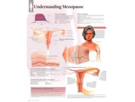 Livro Understanding Menopause Laminated Poster de Scientific Publishing e Various (Inglês)