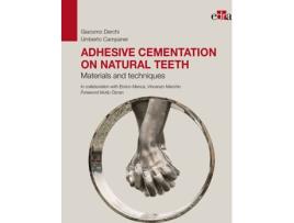 Livro Adhesive Cementation On Natural Teeth. Materials And Techniques de Giacomo Derchi (Inglês)