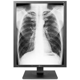 Medical Display 21"" 3:4 21HK512D